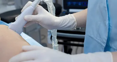 Ultralydscanning av hånd.